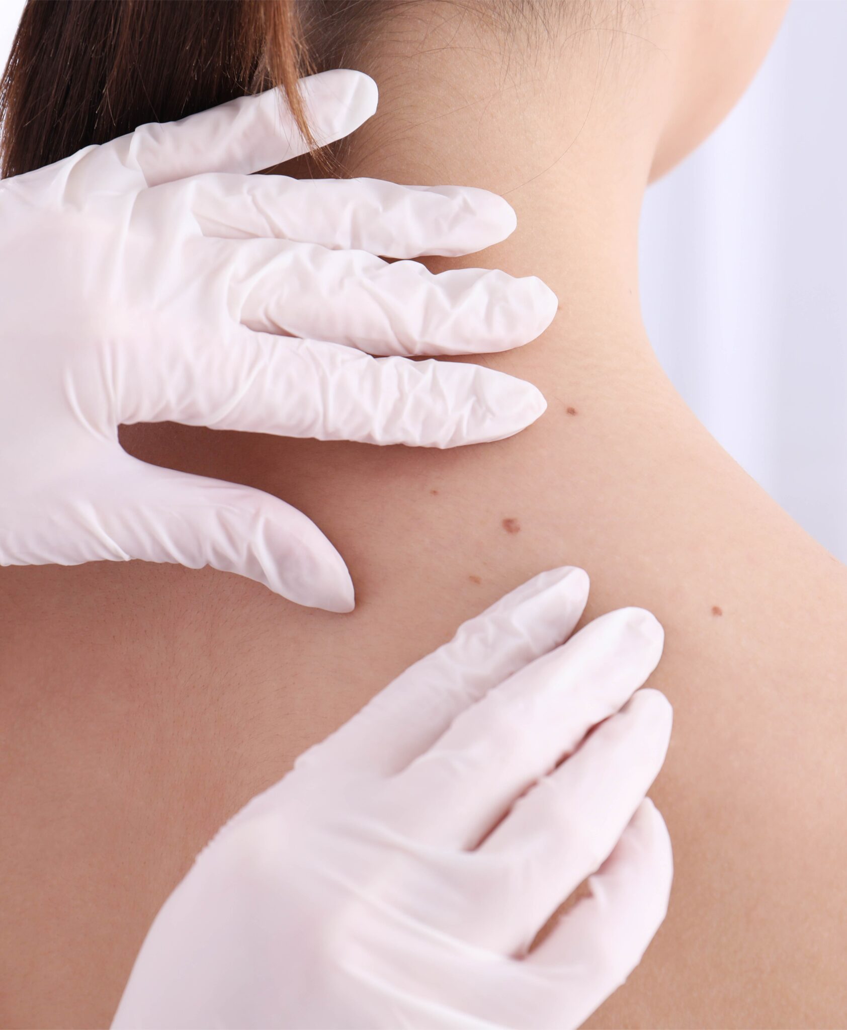 Skin Patch Testing | Omaha | Elkhorn Dermatology