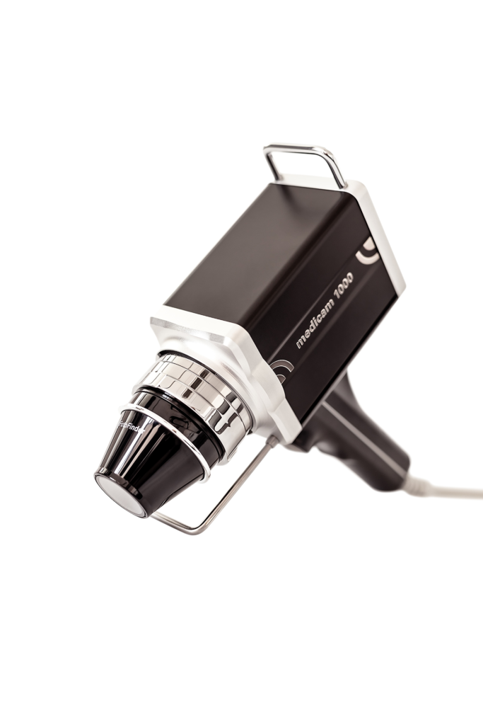 FotoFinder MediCam 1000 dermoscopy camera used for detailed skin lesion evaluation